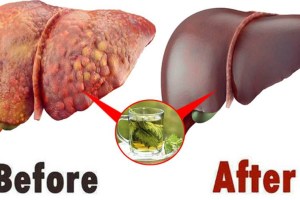 This Plant Can Help Cleanse the Liver, Kidney, and Body From Toxins