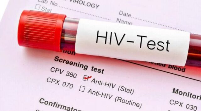 Category of People Who Are Resistant to HIV
