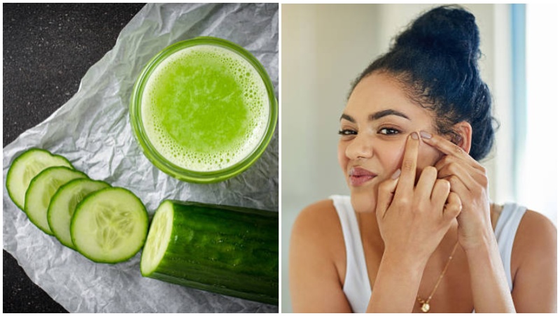 5 effective ways to use cucumber to cure acne naturally